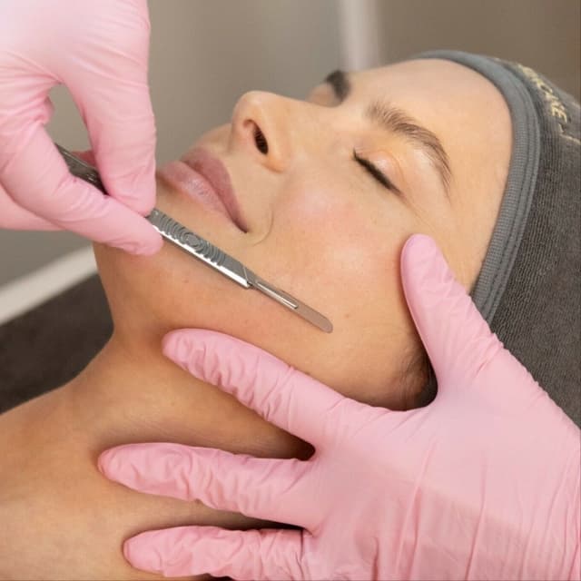 3 Dermaplaning Sessions at Aesthetics by Malory in Lubbock, TX